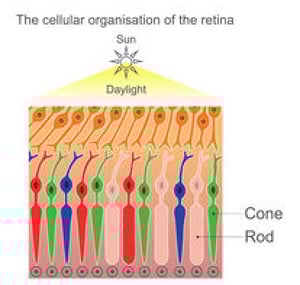 Achromatopsia absence of all three cone photoreceptor