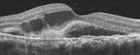The Horizon of Ophthalmology: Embracing a New Era of Vision Restoration - Featured Image