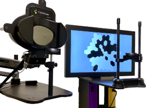 How RP is diagnosed electroretinogram electrodiagnostic  cones rods testing Restore Vision Clinic 0