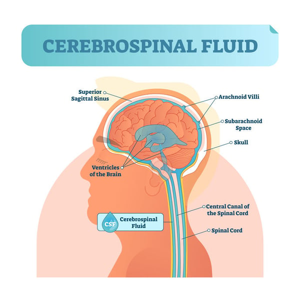 Hydrocephalus Intracranial Pressure Cerebrospinal fluid Optic Nerve Treatment Restore Vision Clinic