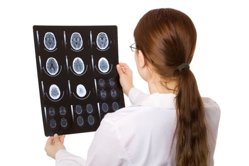 Idiopathic Intracranial Hypertension Neuroimaging MRI CT Restore Vision Clinic