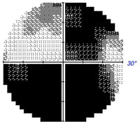 Importe - 1 von 1 (13)