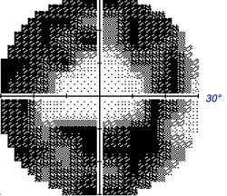 Importe - 1 von 1 (16)
