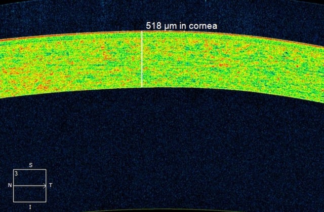 Importe - 1 von 1 (26)