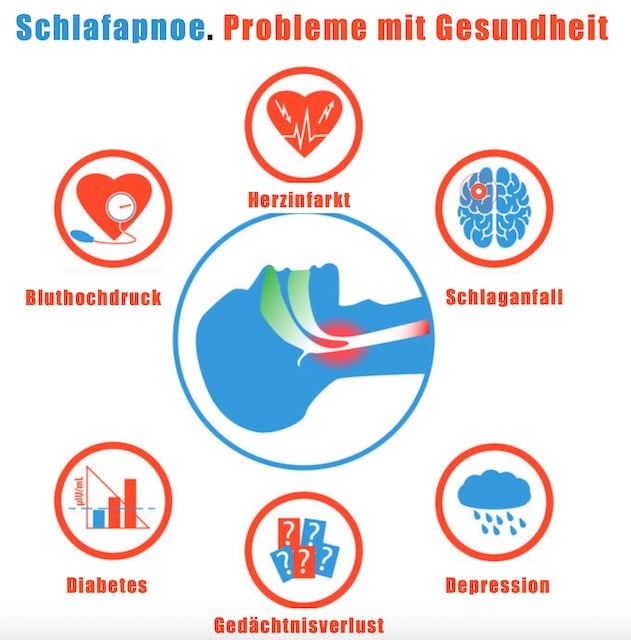 Schlafapnoe. Probleme mit Gesundheit