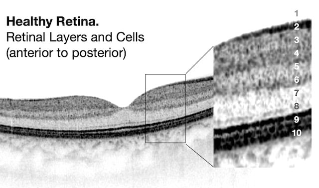 Structure of the retina, photoreceptors, cones rods RP, retinal layers