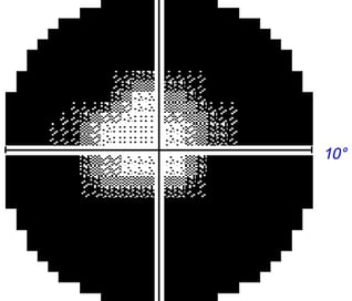 Importe - 1 von 2