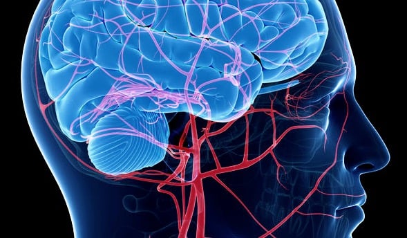 Ischemic Optic Neuropathy NAION Vision Loss-1