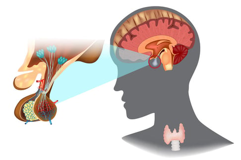 Optic Nerve Hypoplasia Hypothalamic and pituitary dysfunction growth hormone hypothyroidism adrenal insufficiency diabetes insipidus Fedorov Restore Vision Clinic 