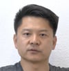 Restore Vision Clinic Patient Optic Neuritis Story