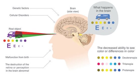 achromatopsia is sometimes referred to as total color blindness