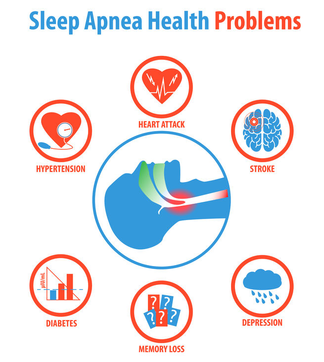 obstructive sleep apnea health related complications diseases